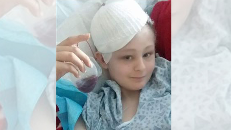 [핫뉴스] 뇌손상 美 13살 소년, 생명유지장치 제거 하루전 소생 外