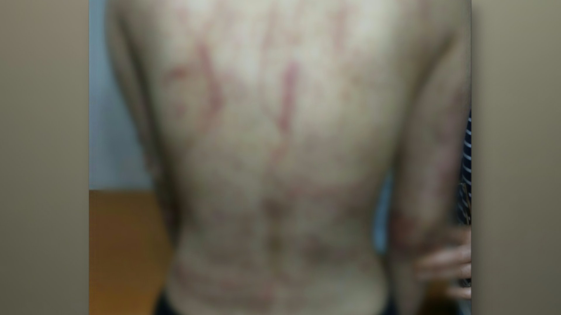 '관악산 집단폭행 사건' 10대 7명 구속