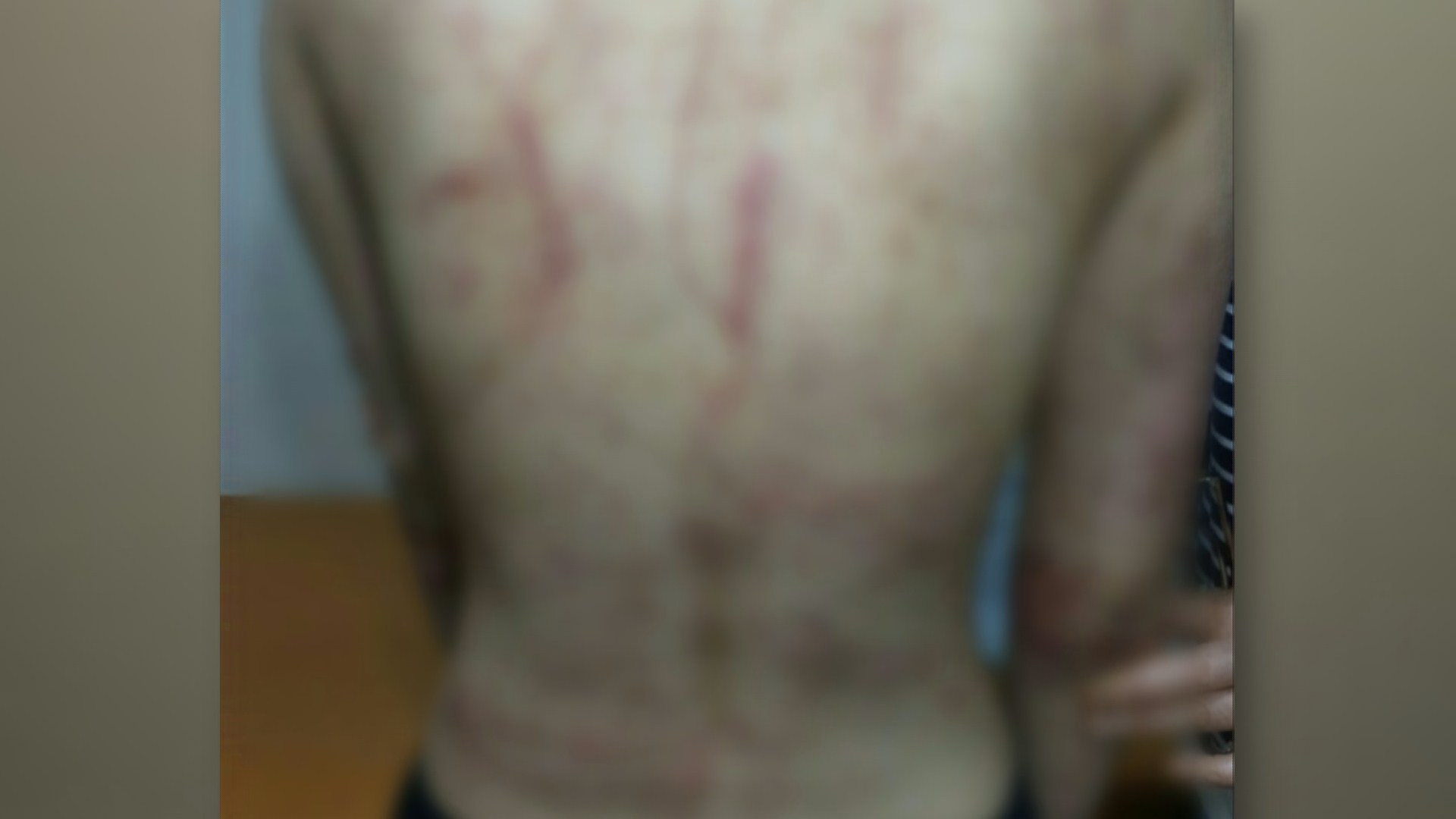 '관악산 고교생 집단폭행' 10대 10명 검찰ㆍ가정법원 송치